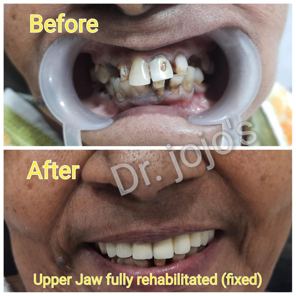 Treatment Result