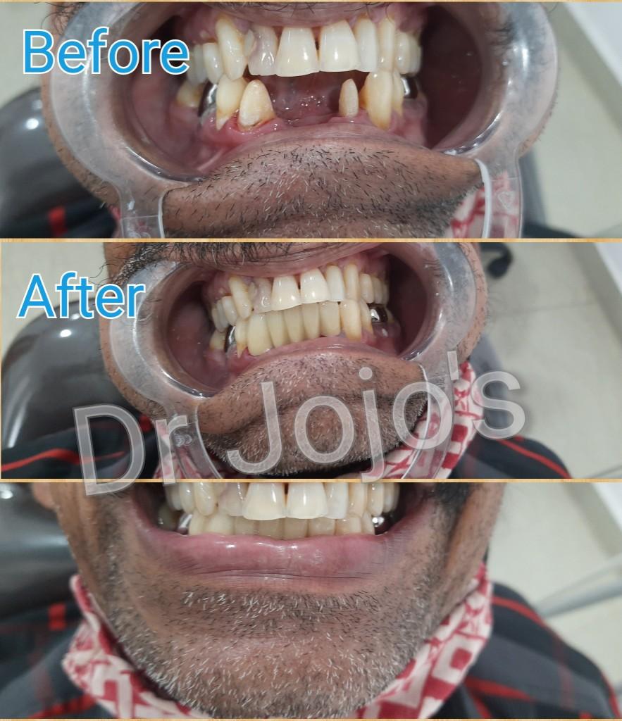 Treatment Result