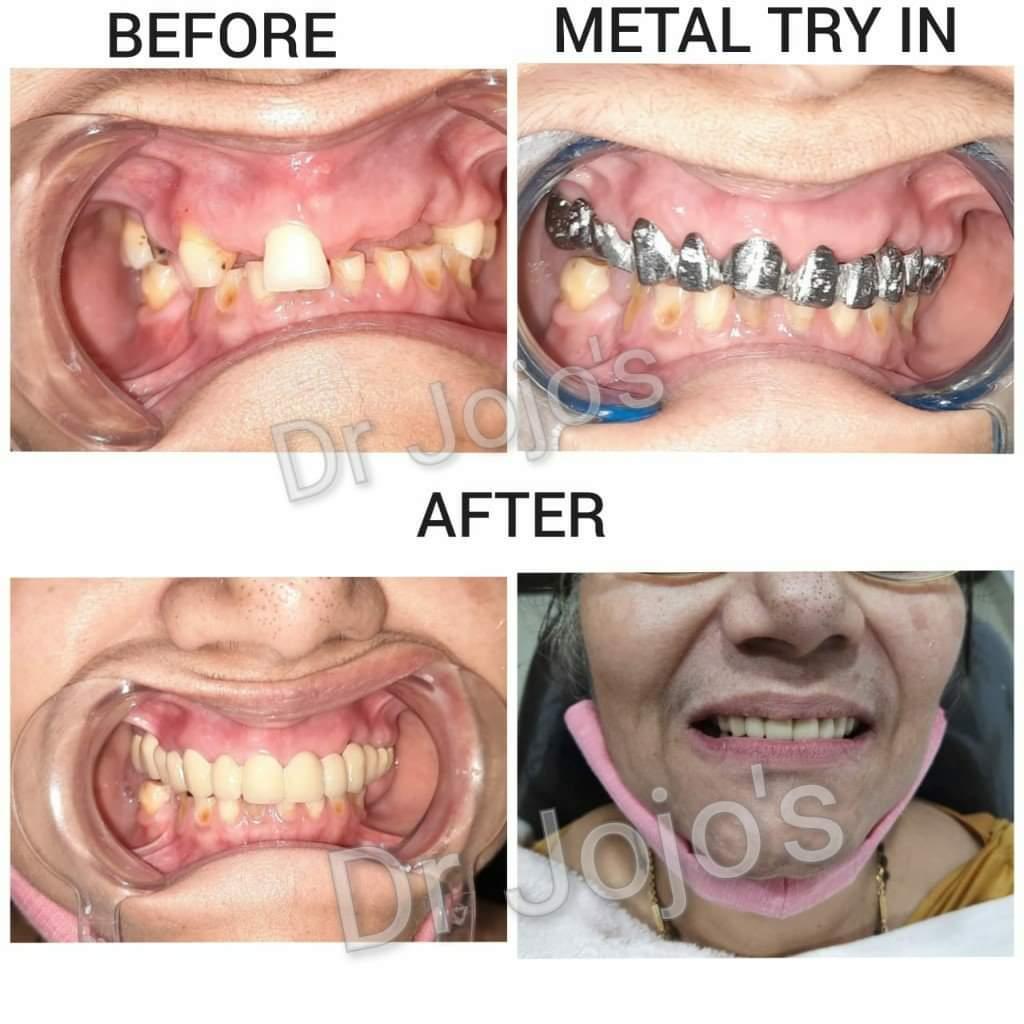 Treatment Result