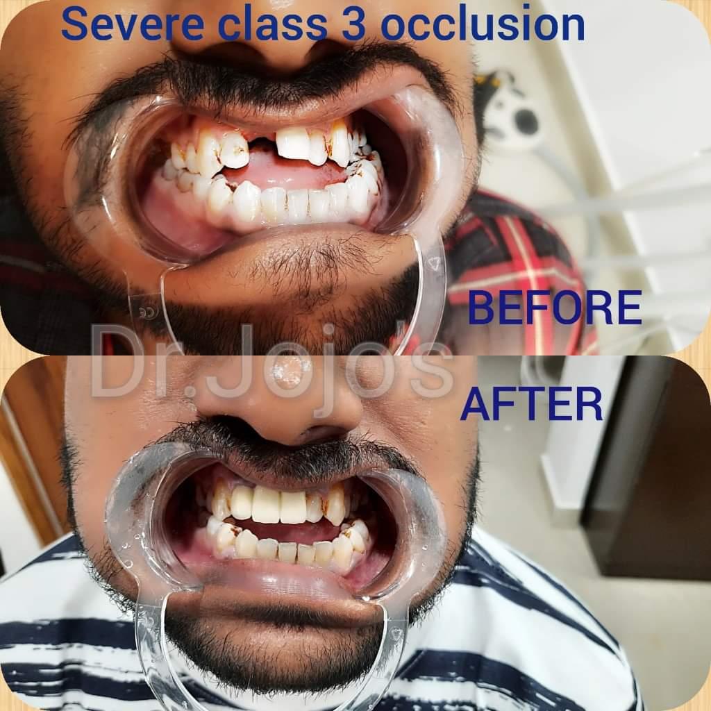 Treatment Result